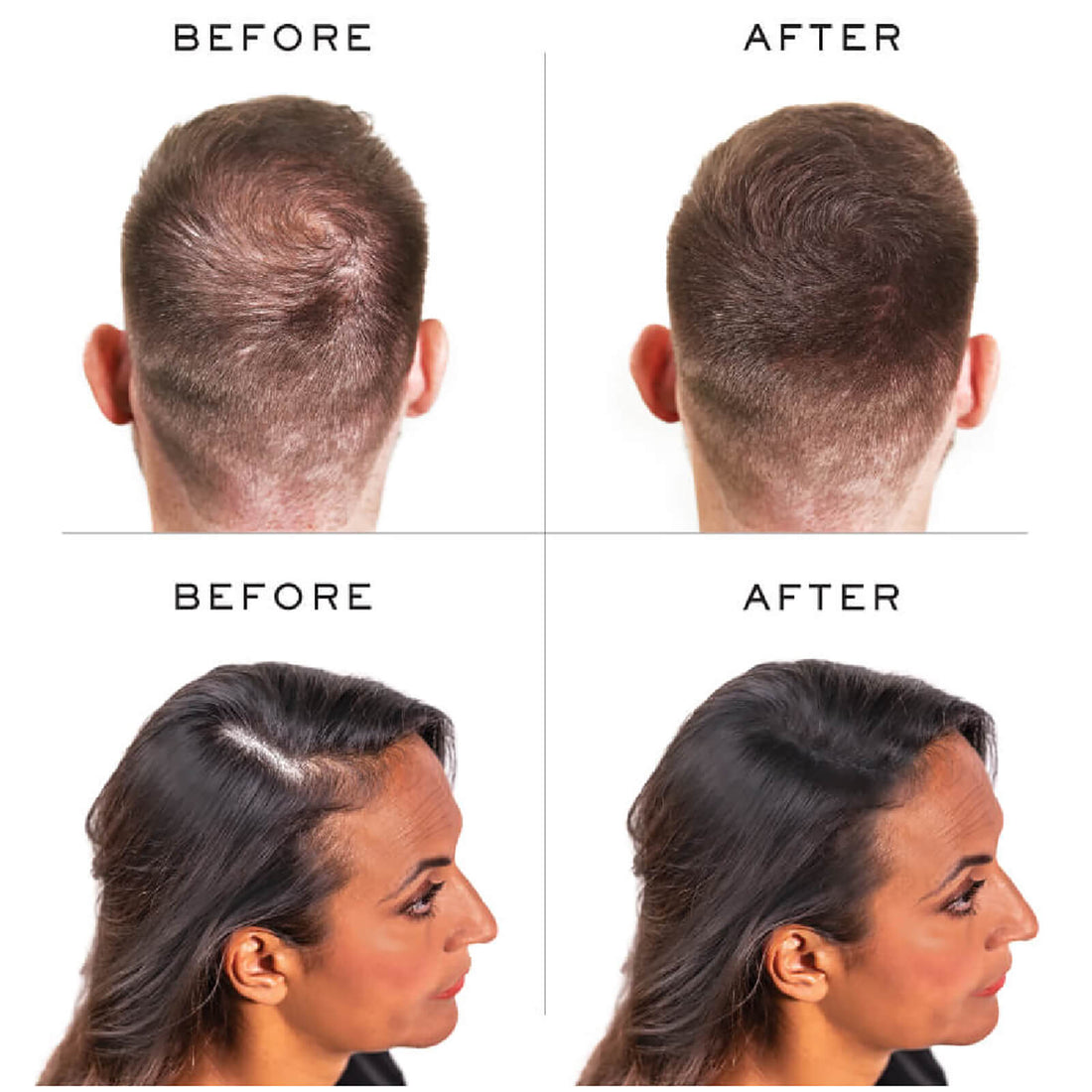 Nanogen Keratin Hair Fibres