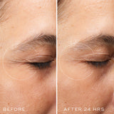 Medik8 Crystal Retinal Ceramide Eye 10