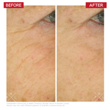 Dr Levy Age-Reverse Stem Cell Cure