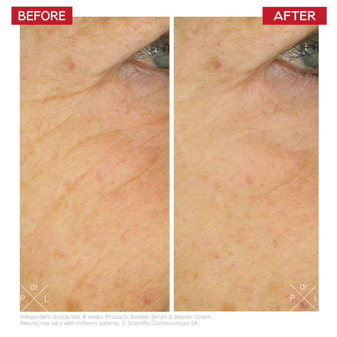 Dr Levy Age-Reverse Stem Cell Cure