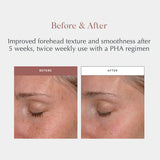 Exuviance Performance Peel AP25 26 pads