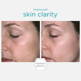 NeoStrata Restore PHA Facial Cleanser