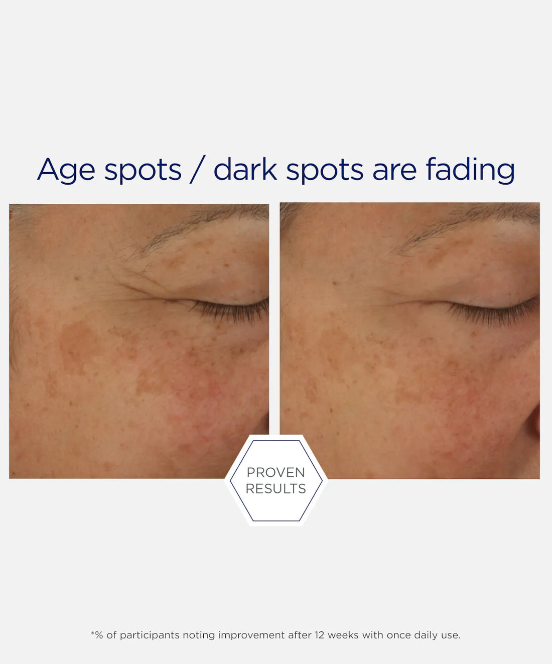 NeoStrata Skin Active Firming Potent Retinol Complex