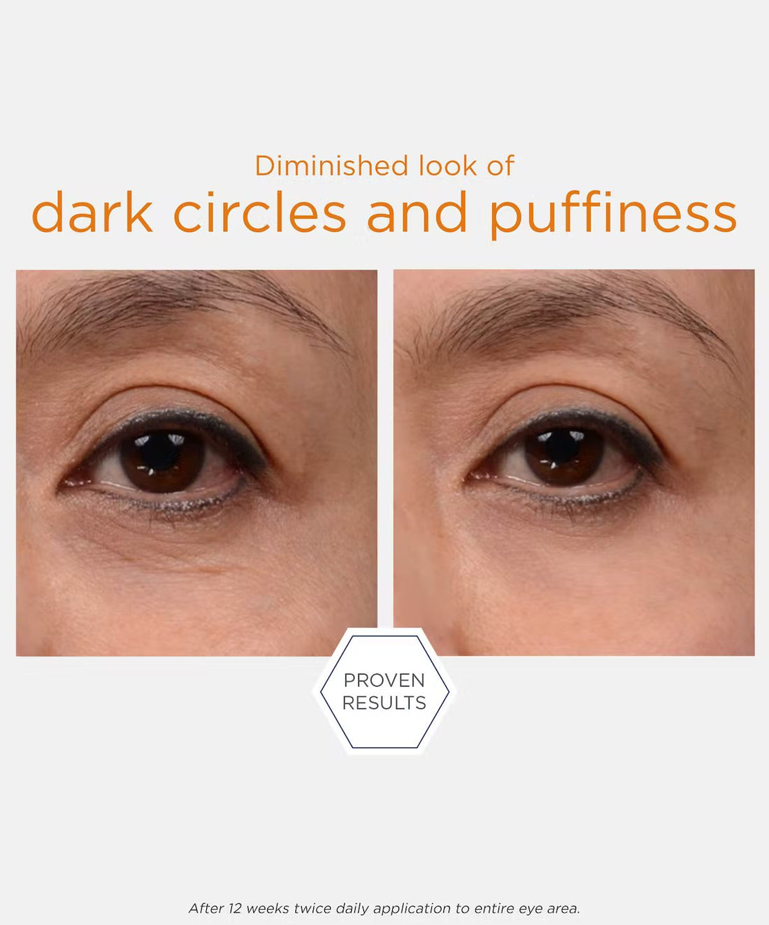 NeoStrata Enlighten Brightening Eye Cream
