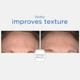 NeoStrata Resurface Smooth Surface Glycolic Peel