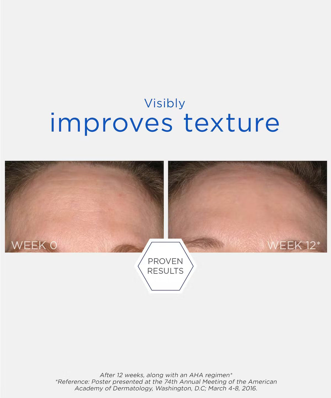 NeoStrata Resurface Smooth Surface Glycolic Peel