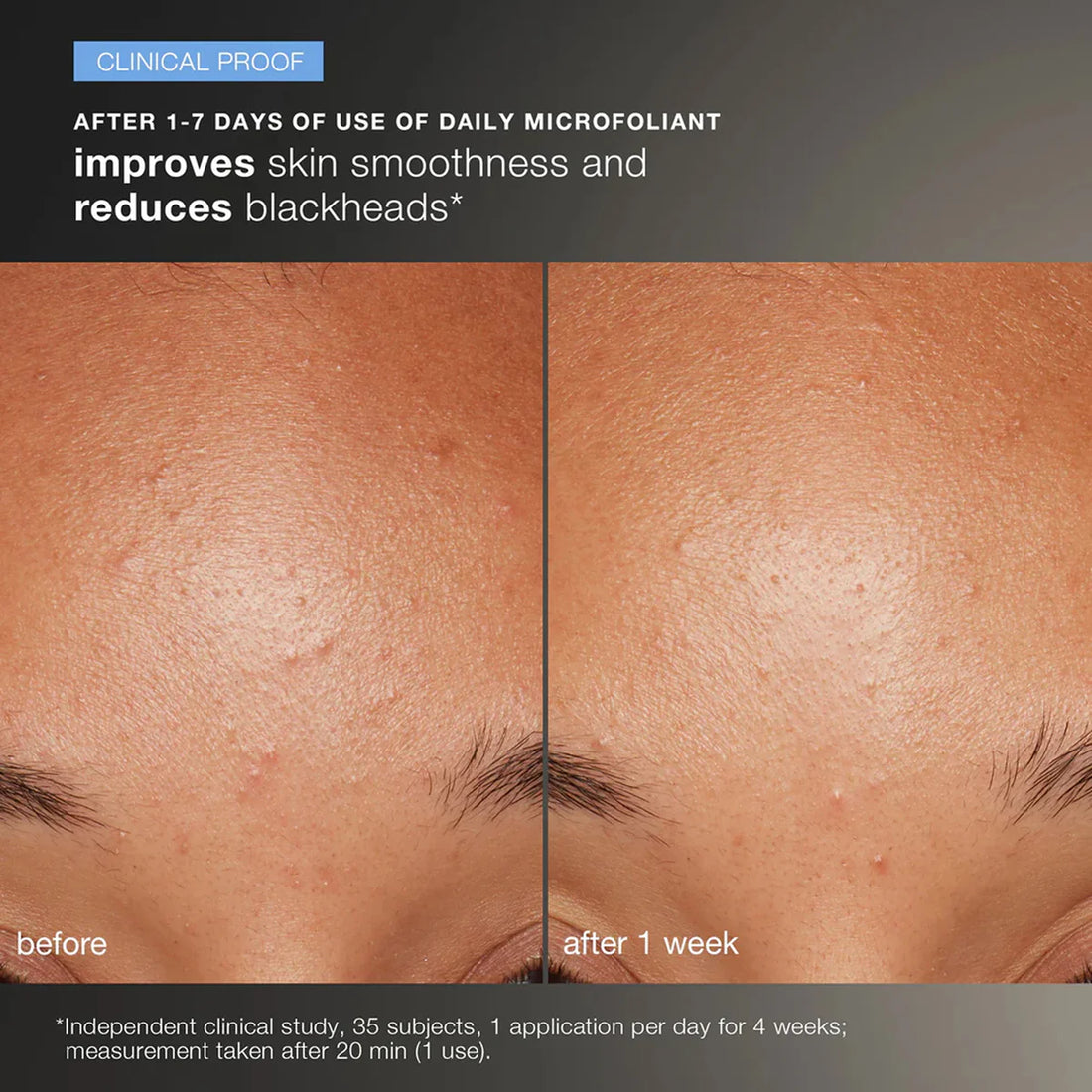 Dermalogica Discover Healthy Skin Kit