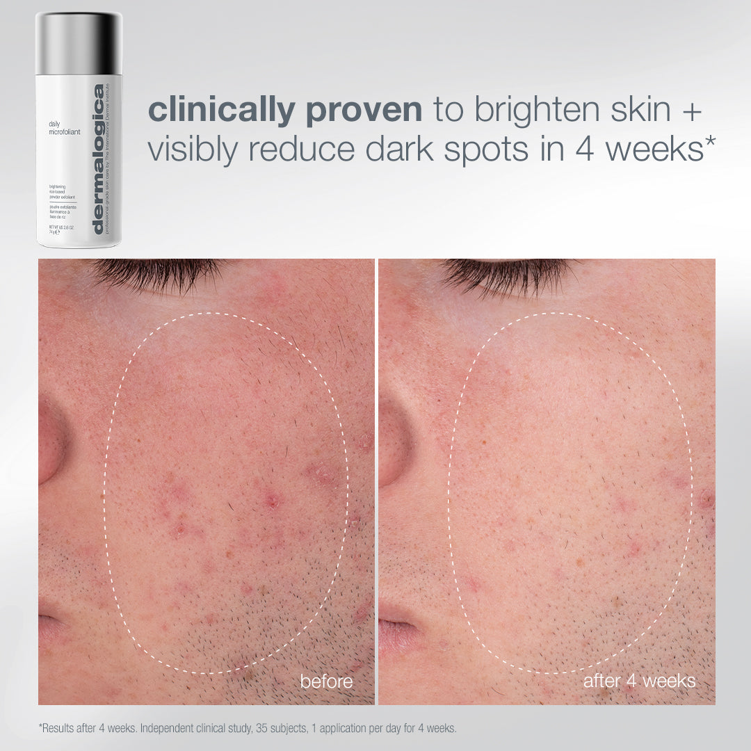 Dermalogica Pro Ritual: Exfoliate + Glow