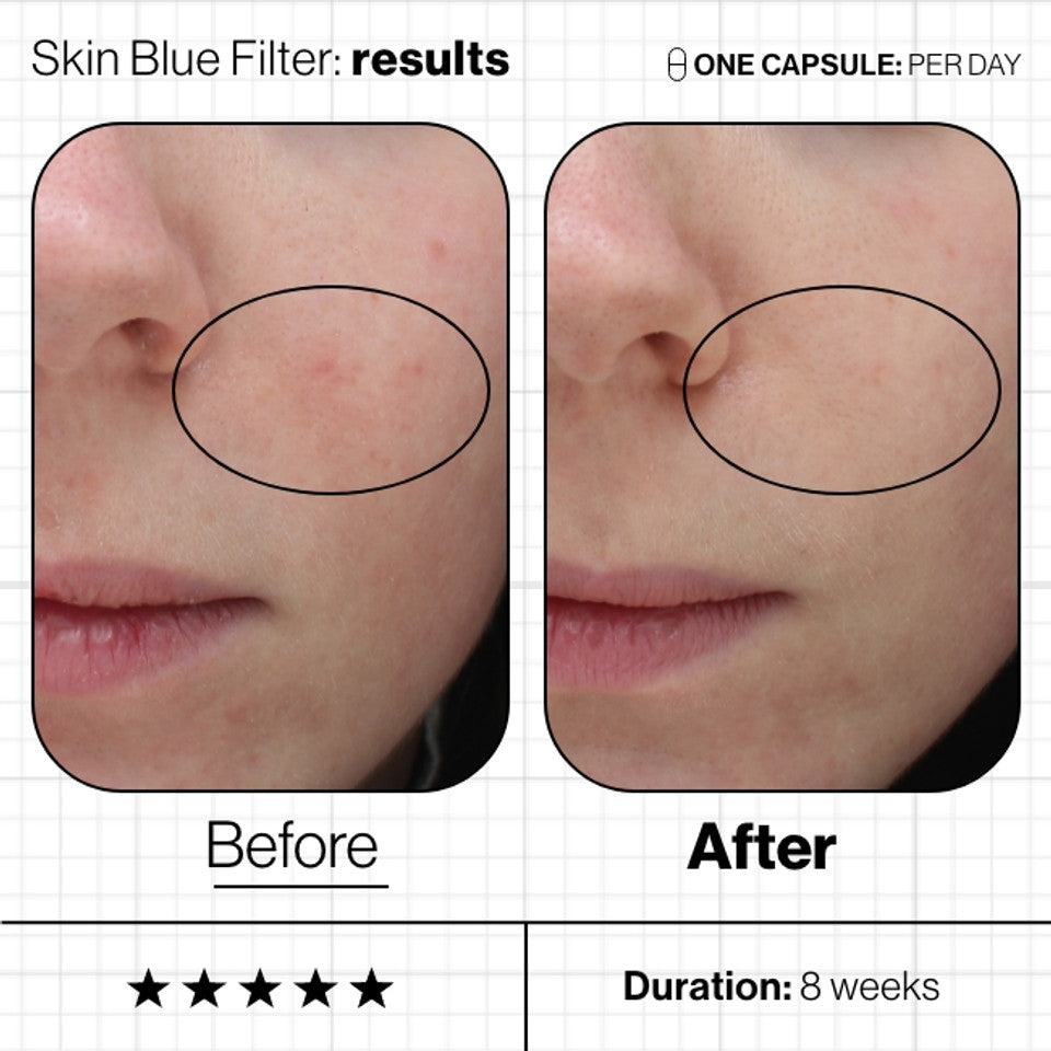 Advanced Nutrition Programme Skin Blue Filter, before and after
