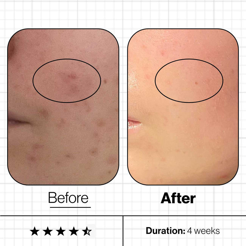 Translucent Skin Growth Skin Clear Biome | Advanced Nutrition Programme & The Derma Company