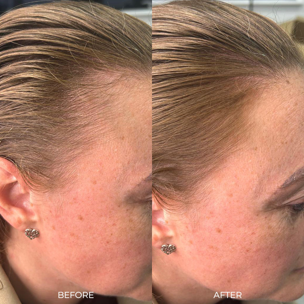 Nanogen Root Concealer