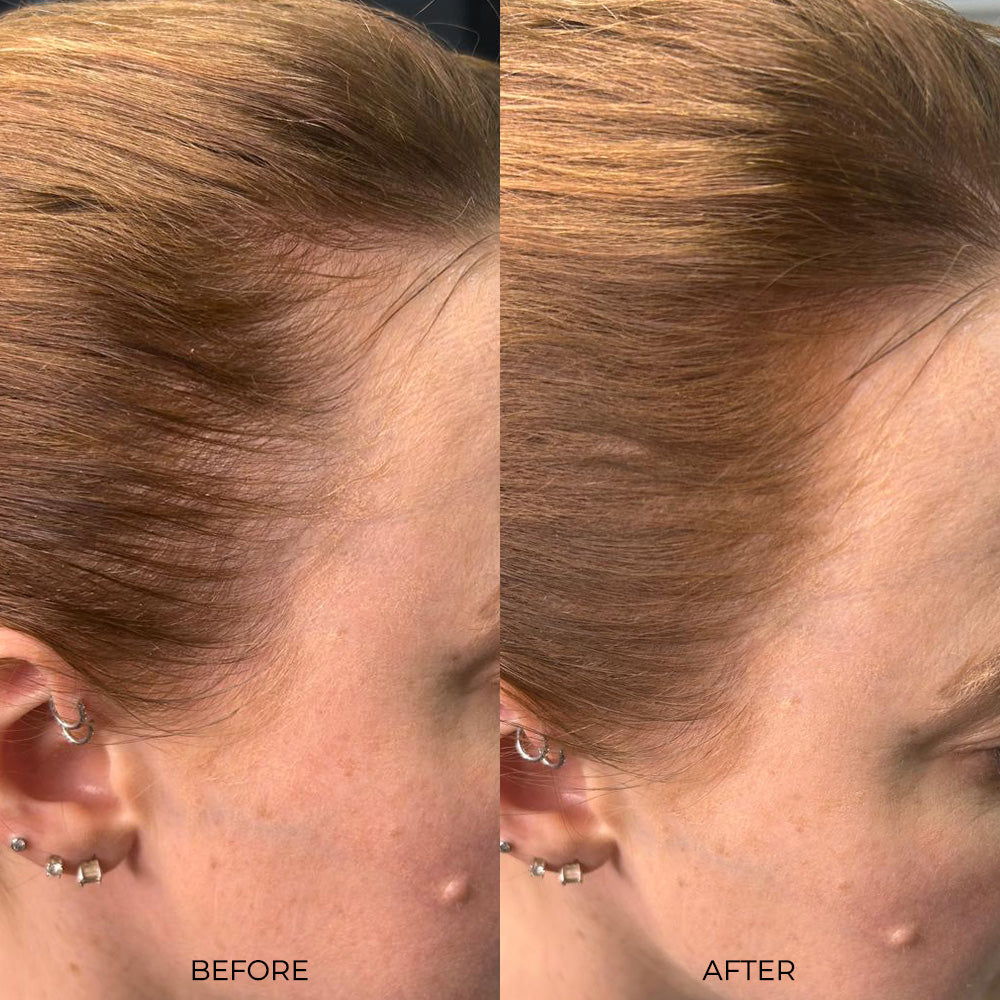 Nanogen Root Concealer