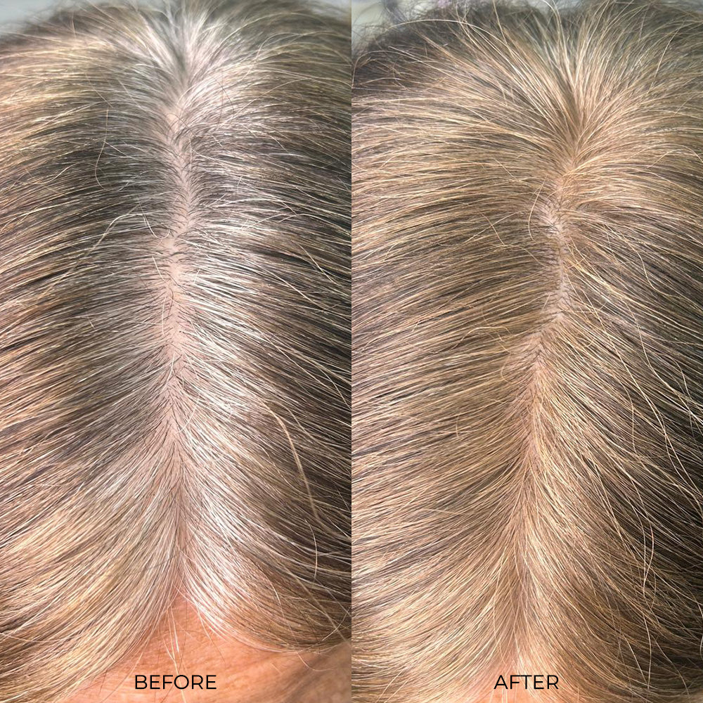 Nanogen Root Concealer