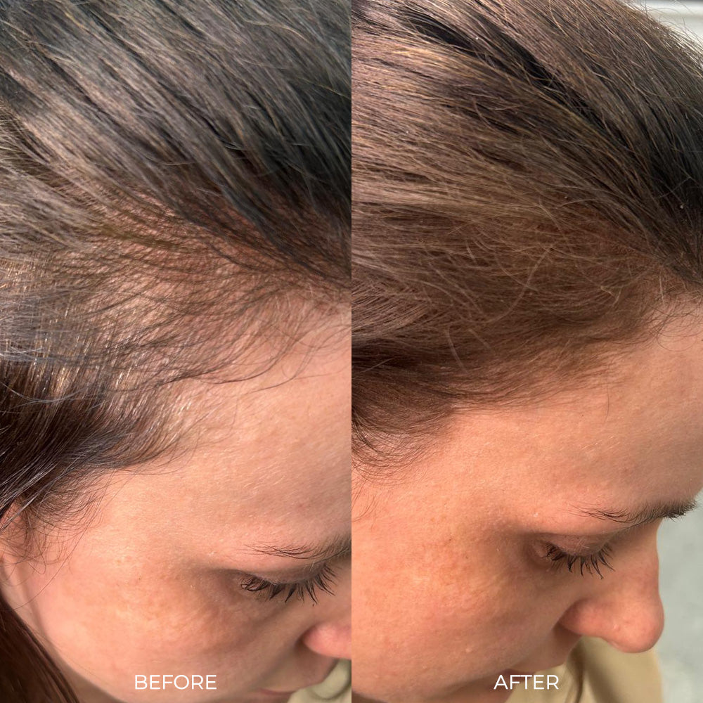 Nanogen Root Concealer