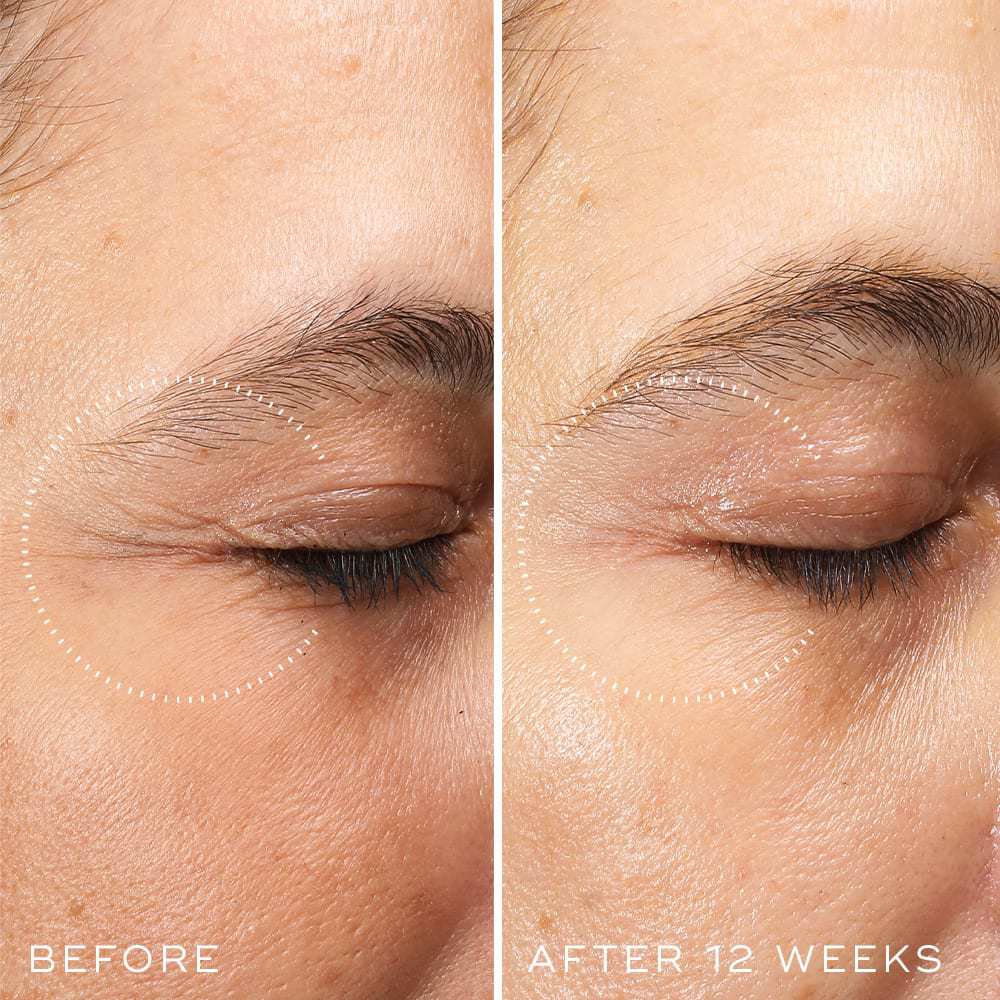 Medik8 Crystal Retinal Ceramide Eye 3, view 10