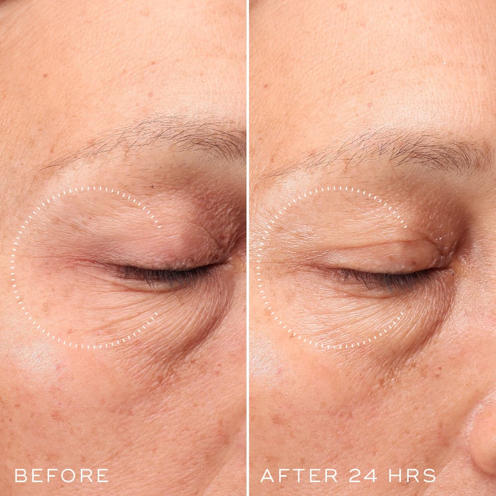 Medik8 Crystal Retinal Ceramide Eye 6