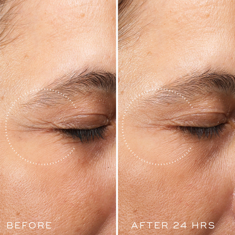 Medik8 Crystal Retinal Ceramide Eye 3, view 8