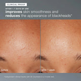 Dermalogica Daily Microfoliant