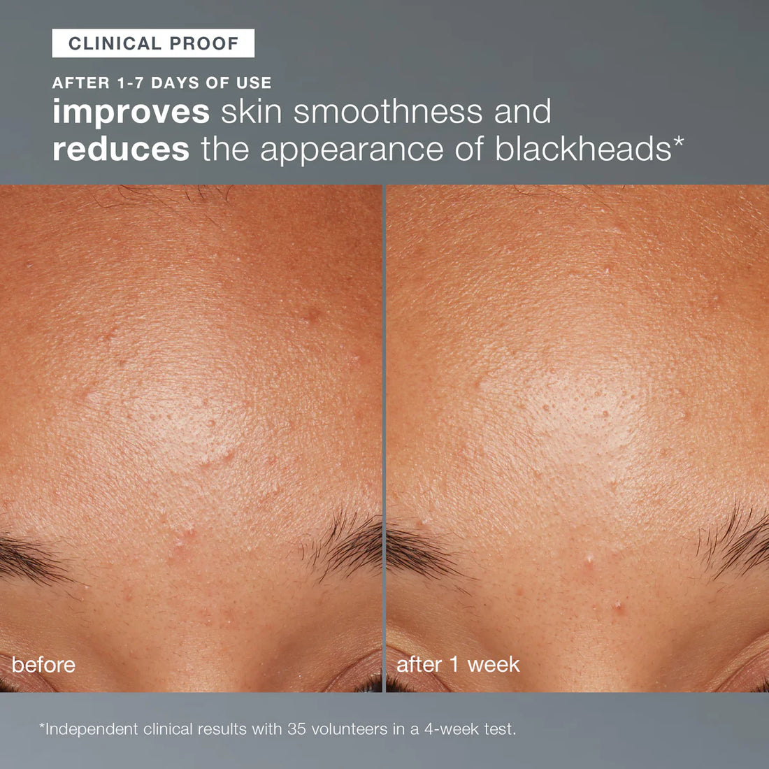 Dermalogica Daily Microfoliant