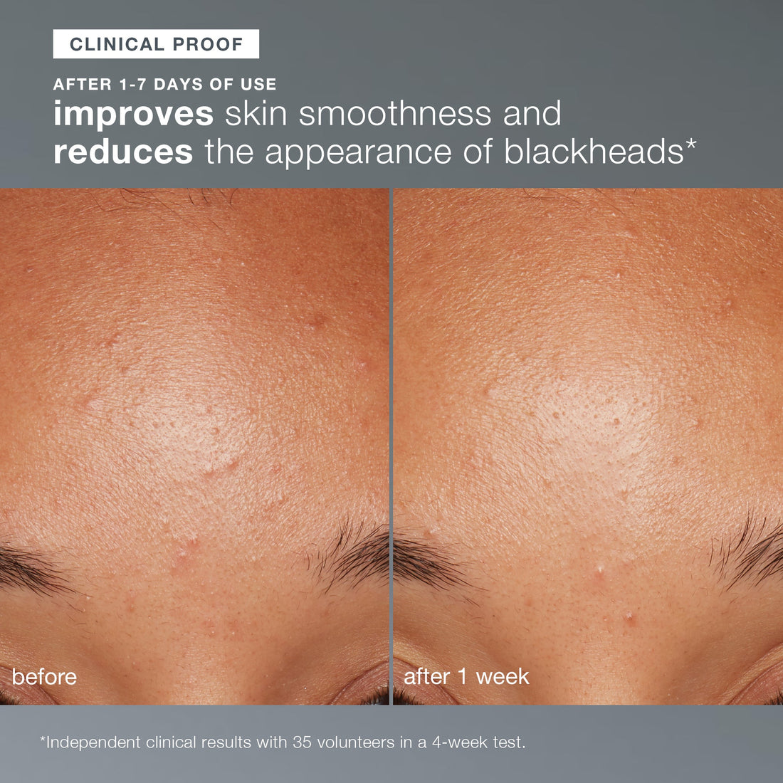 Dermalogica PreCleanse + Daily Microfoliant