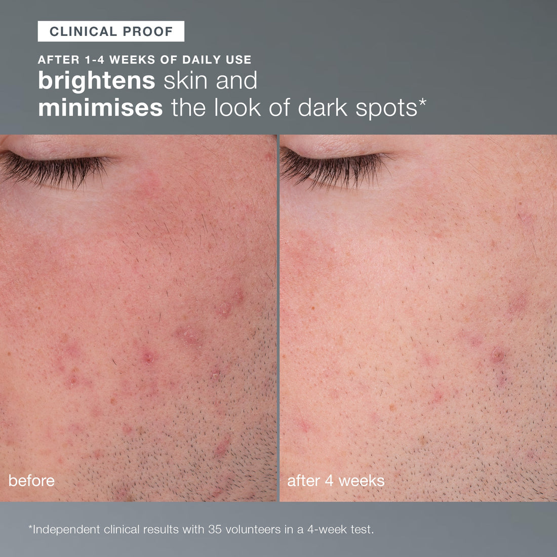 Dermalogica Smooth + Protect Duo