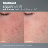 Dermalogica Daily Microfoliant