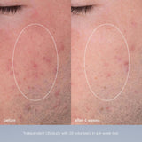 Dermalogica Special Cleansing Gel + Daily Microfoliant