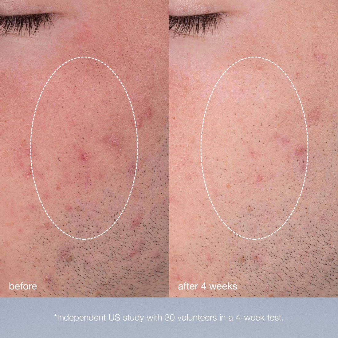 Dermalogica Special Cleansing Gel + Daily Microfoliant