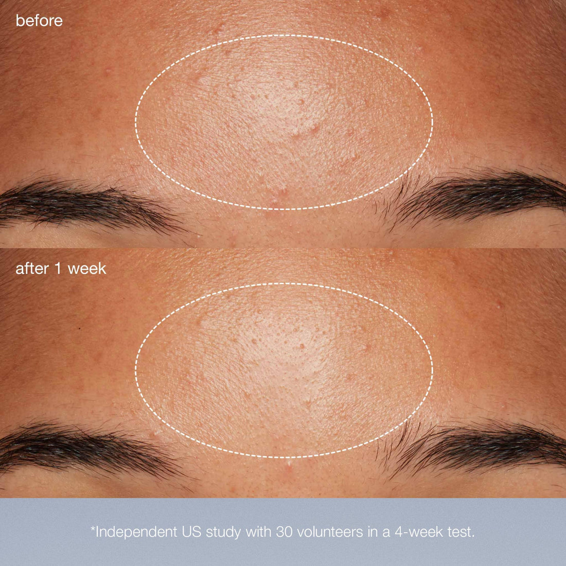Dermalogica Special Cleansing Gel + Daily Microfoliant