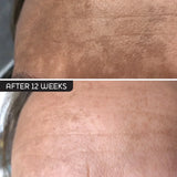 Dermaceutic Mela Cream