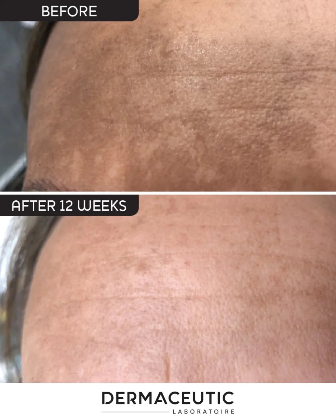 Dermaceutic Mela Cream