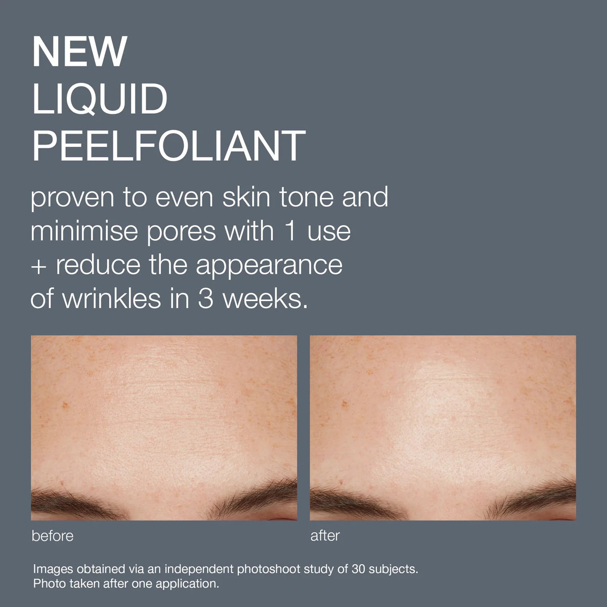 Dermalogica Liquid Peelfoliant 59ml, view 2