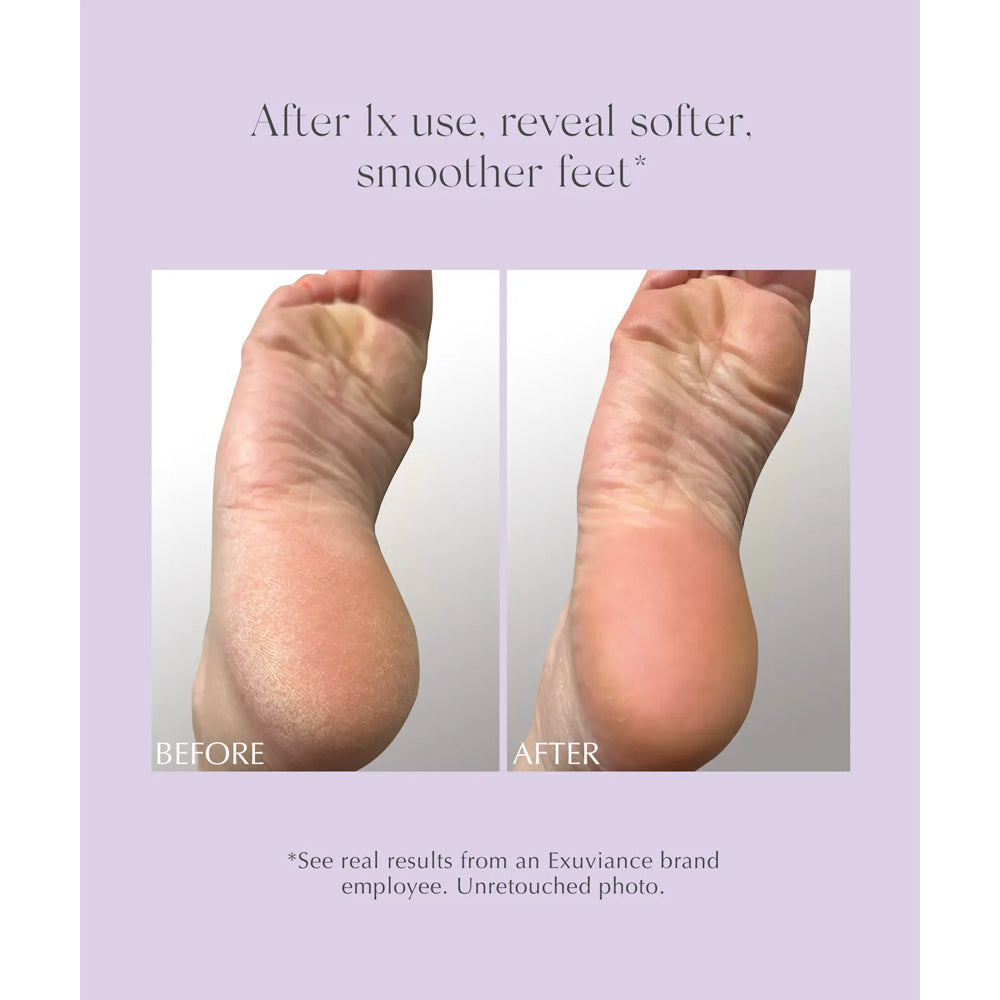 Exuviance Exfoliating & Conditioning Foot Balm, before and after