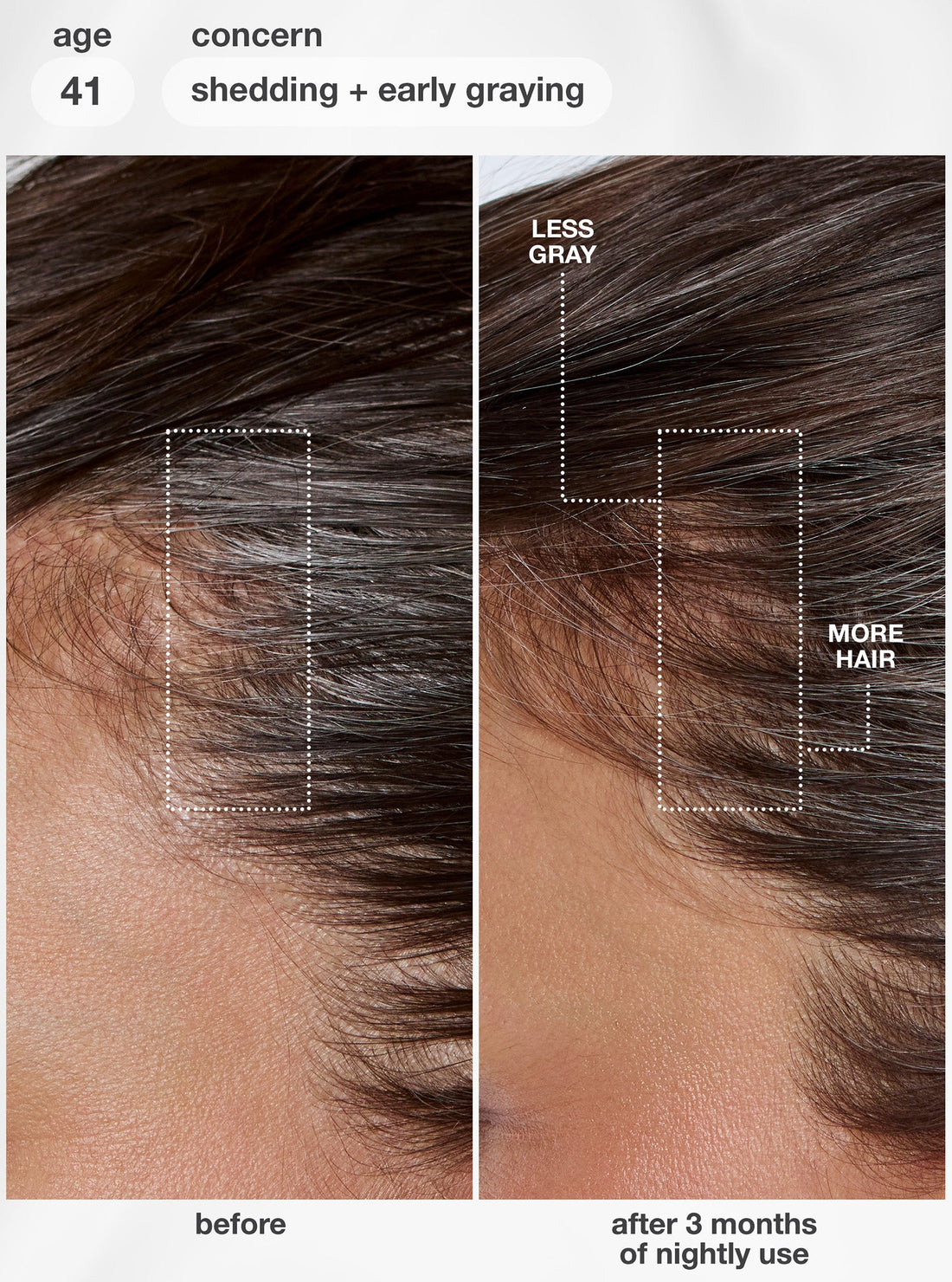K18 FutureIQ Biomimetic Hair Longevity Serum