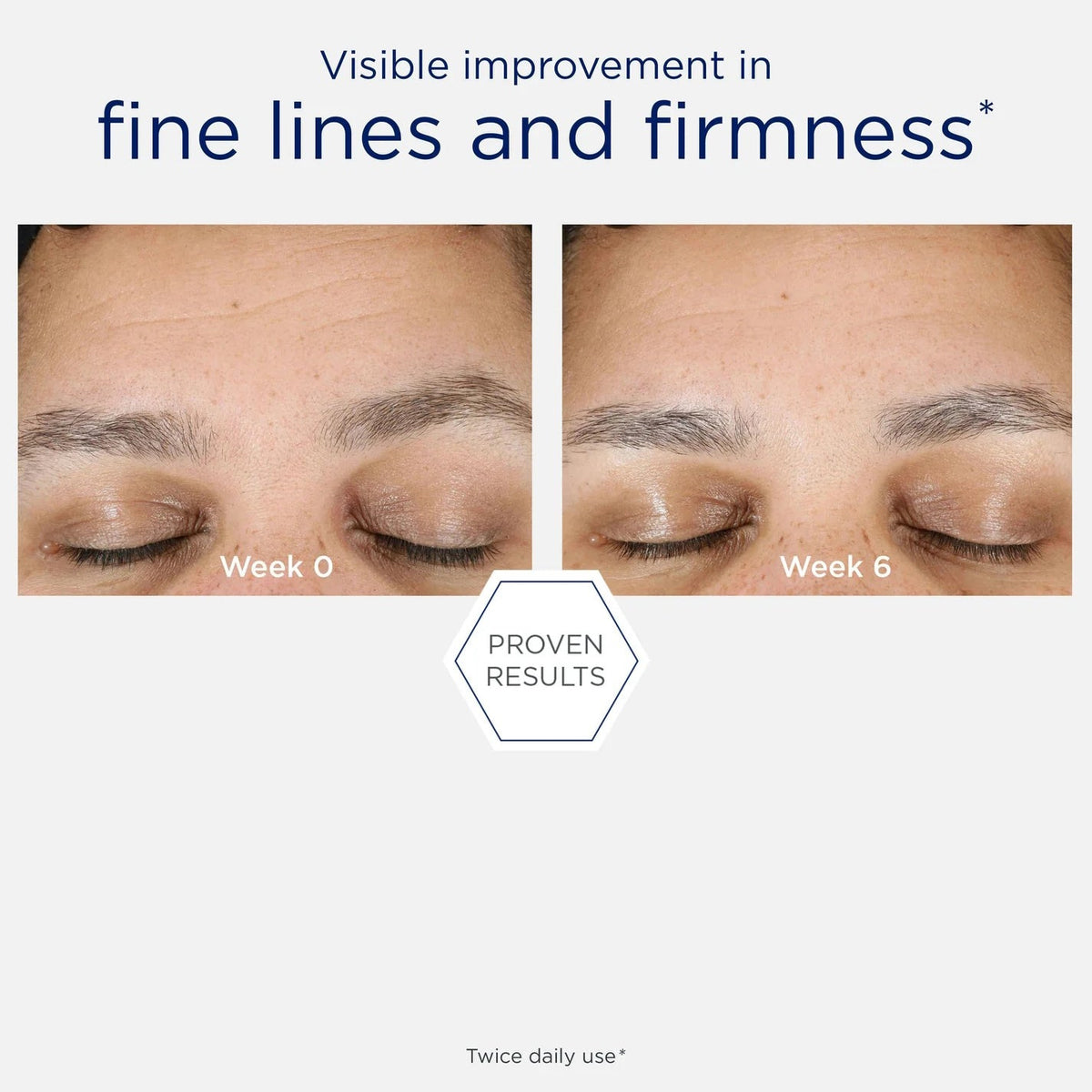 NeoStrata Skin Active Firming Hyaluronic Luminous Lift