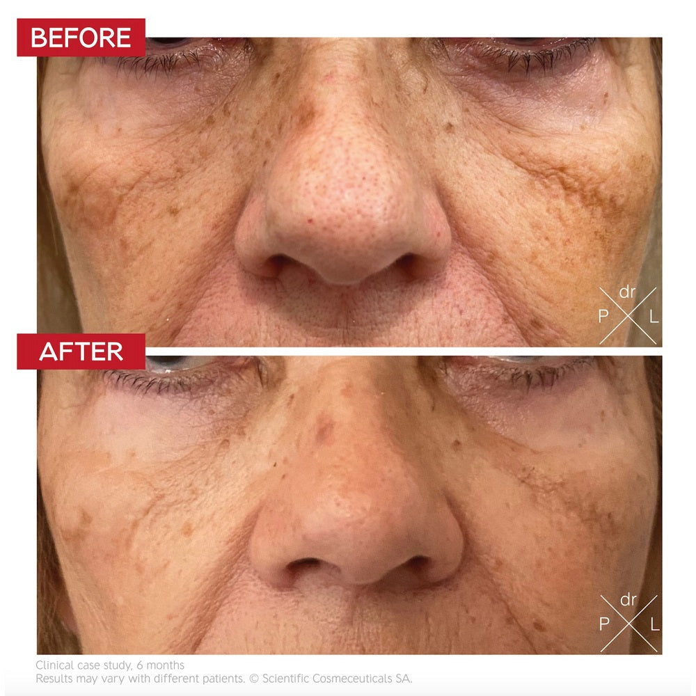 Dr Levy Pigment Control Drops