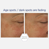NeoStrata Skin Active Firming Potent Retinol Complex