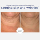 NeoStrata Skin Active Triple Firming Neck Cream