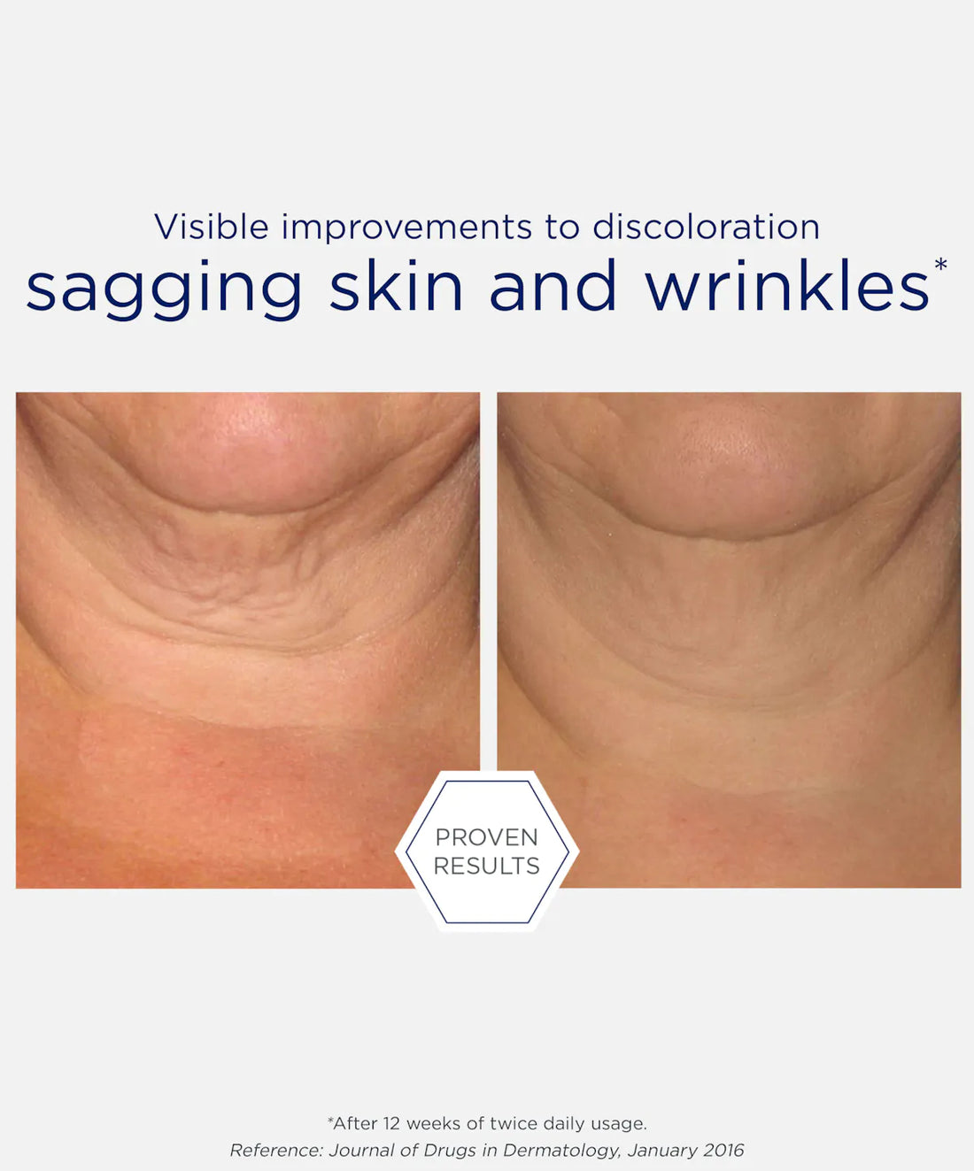 NeoStrata Skin Active Triple Firming Neck Cream