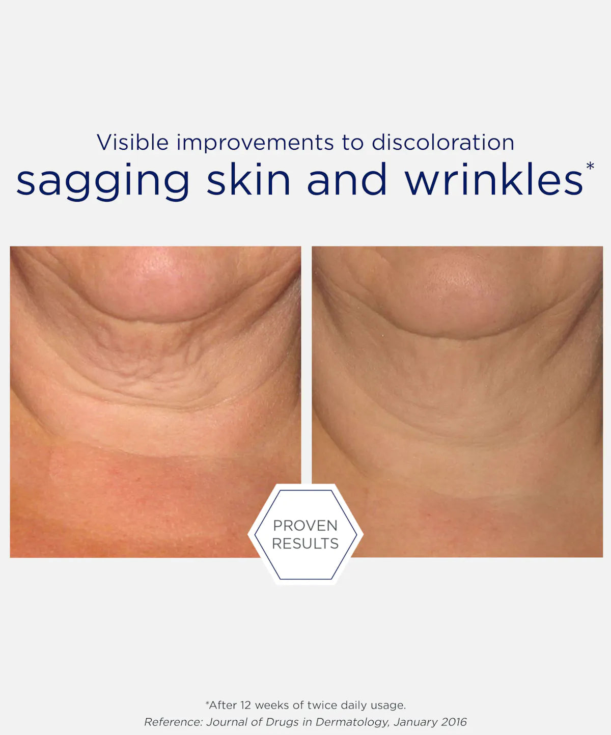 NeoStrata Skin Active Triple Firming Neck Cream, view 6