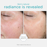NeoStrata Restore PHA Renewal Pads