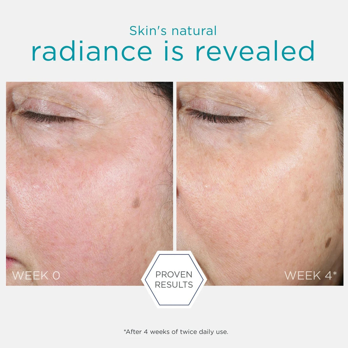 NeoStrata Restore PHA Renewal Pads