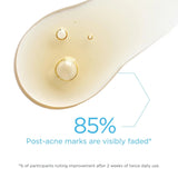 NeoStrata Clarify Post-Acne Mark Correcting Serum 30ml