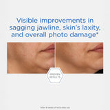 NeoStrata Skin Active Rebound Sculpting Cream