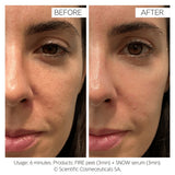 Dr Levy Fire & Snow Peel & Serum