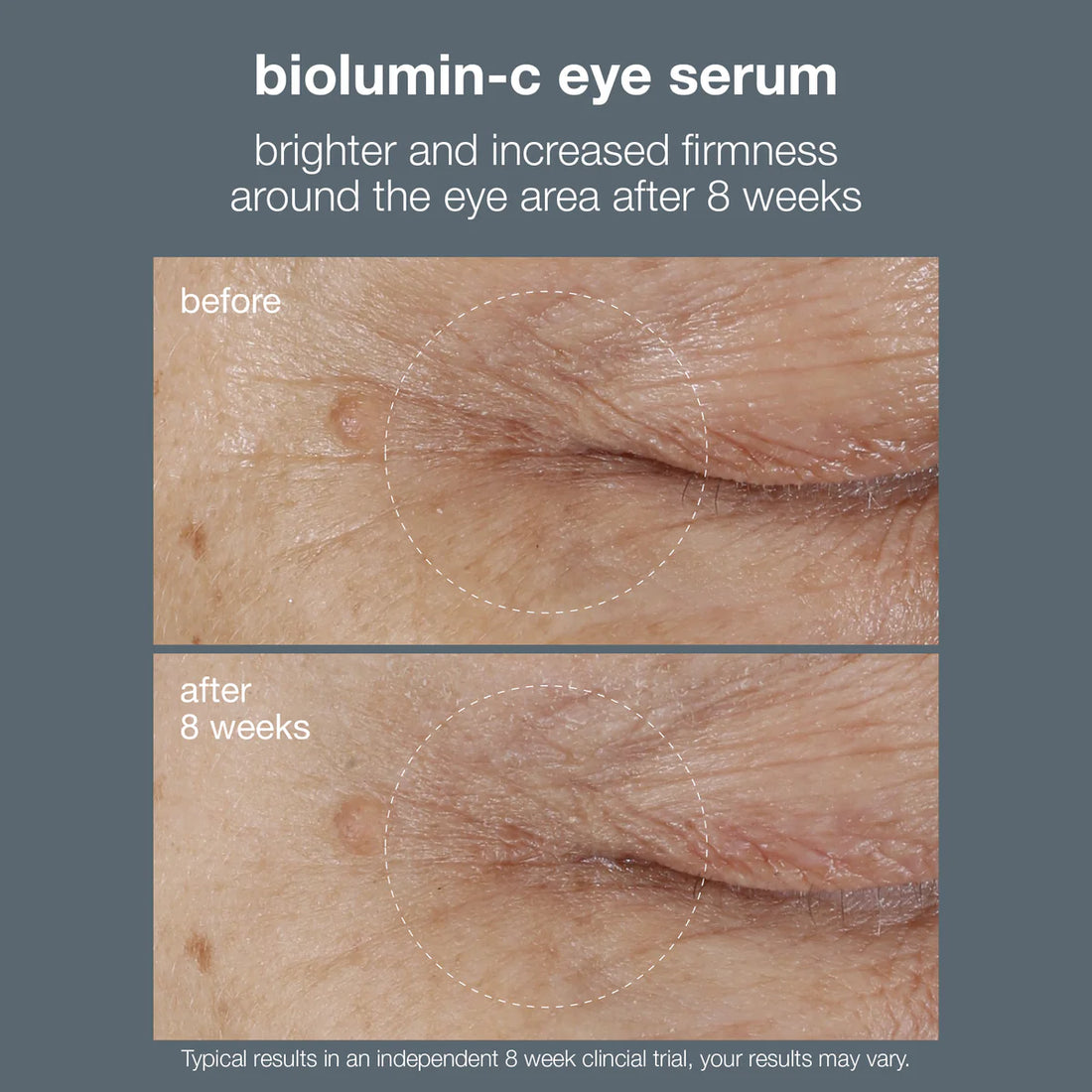 Dermalogica BioLumin-C Eye Serum