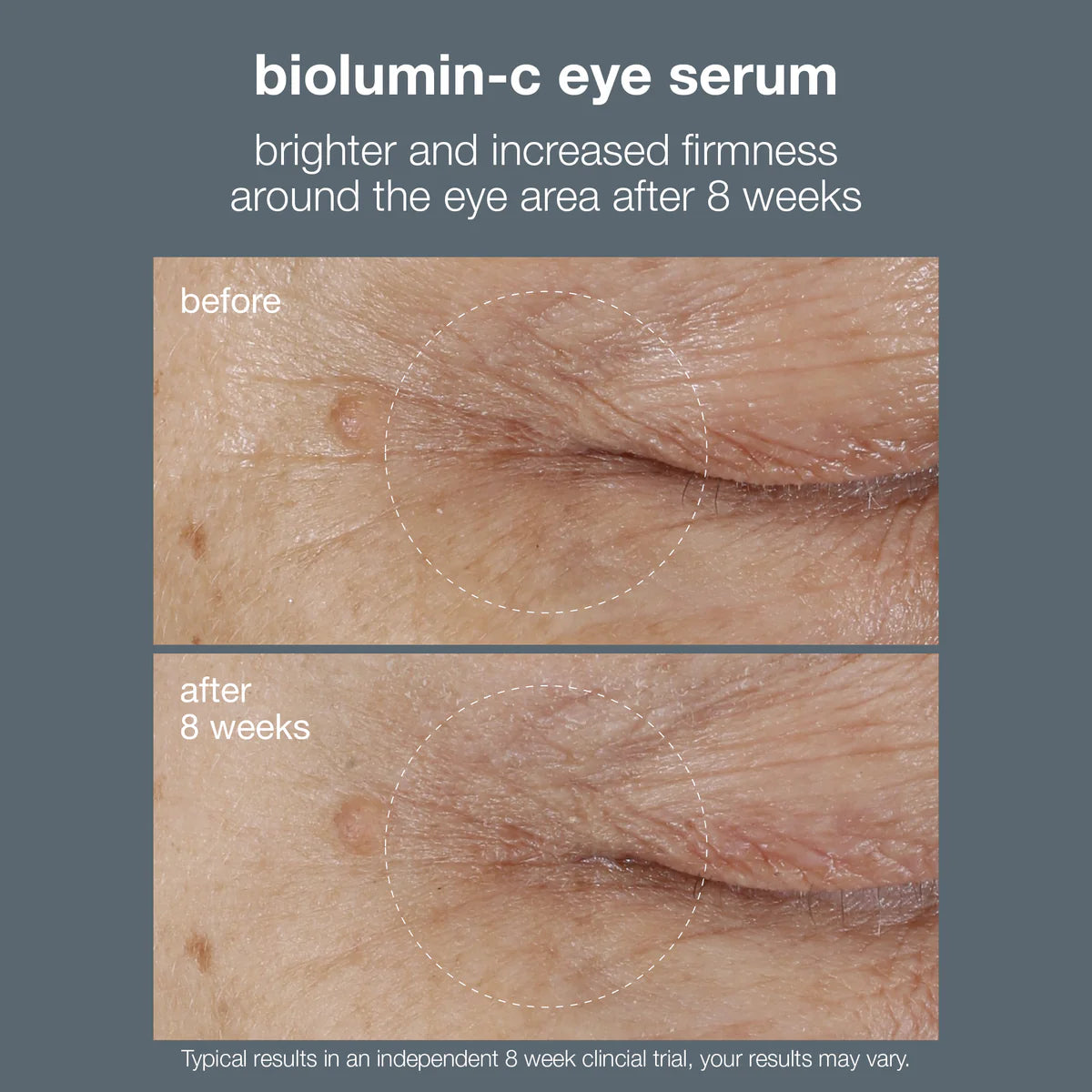 Dermalogica BioLumin-C Eye Serum, view 5