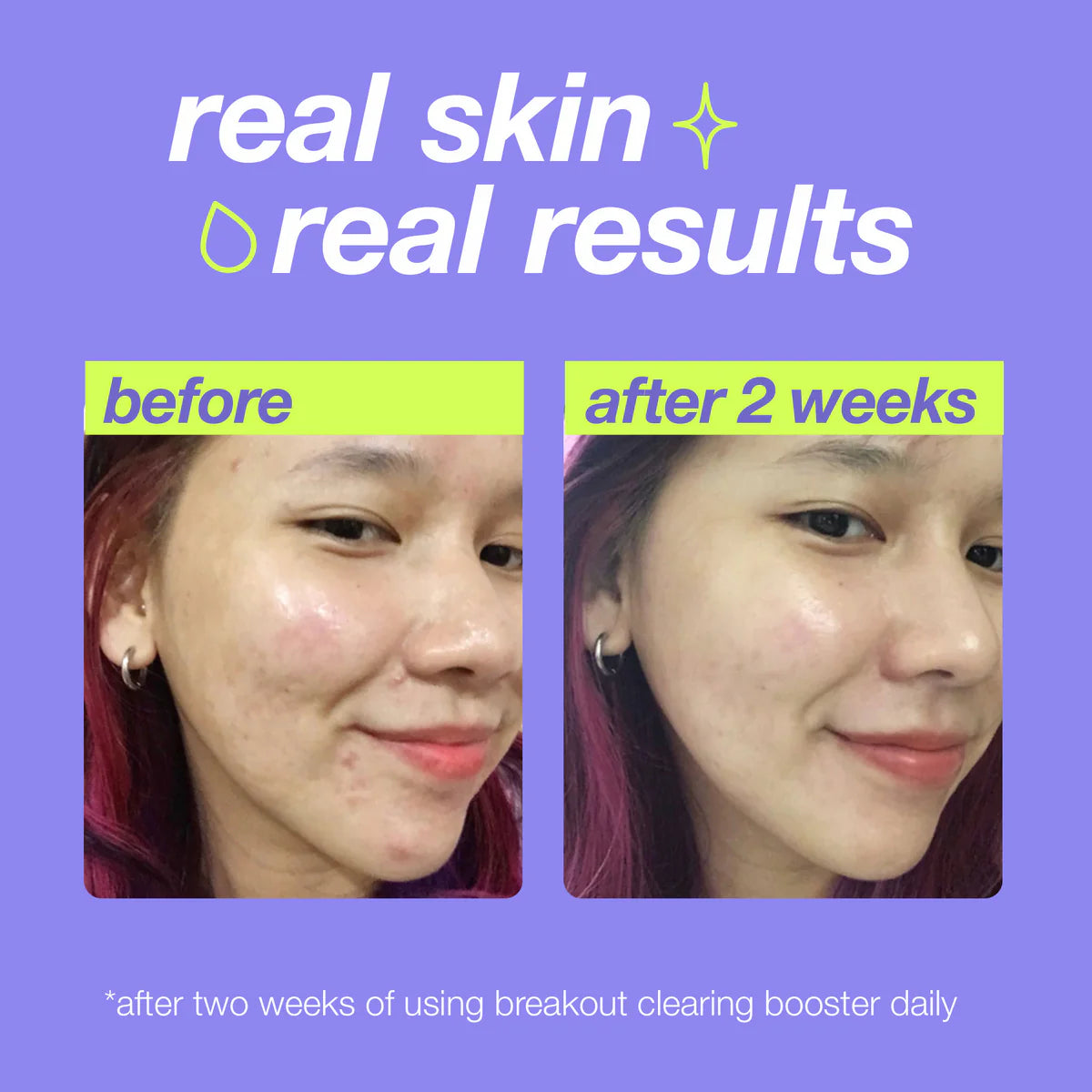 Dermalogica Breakout Clearing Booster 30ml, view 6