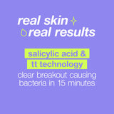 Dermalogica Breakout Clearing + Hydration Bundle