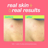 Dermalogica Body Breakout Duo